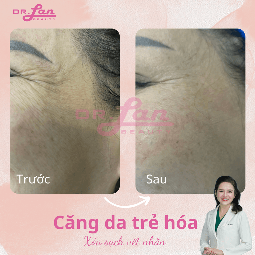 Ăn bữa sáng có chứa protein