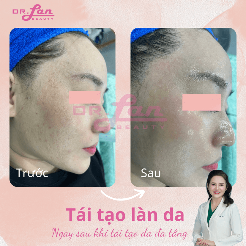 Tập thể dục buổi sáng thay vì buổi chiều tối