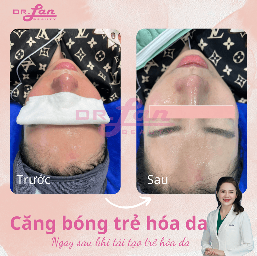 Sử dụng chai xịt khoáng