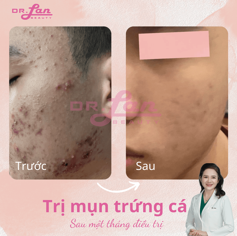 Sử dụng serum/kem dưỡng da hàng ngày